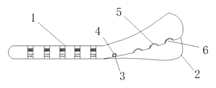 Adjustable Height-Increasing Insole with Internal Shim Stack - Patent drawing - assembled insole