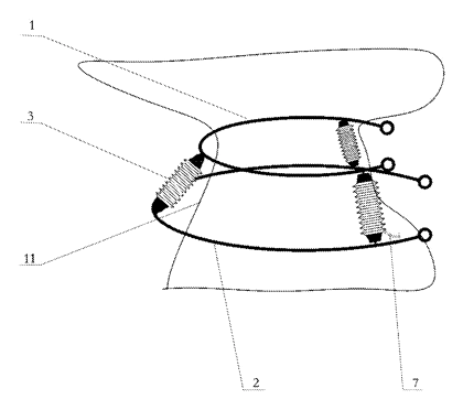 Pneumatic Multi-Directional Neck Traction Collar - Patent drawing - overall structure of the neck traction collar